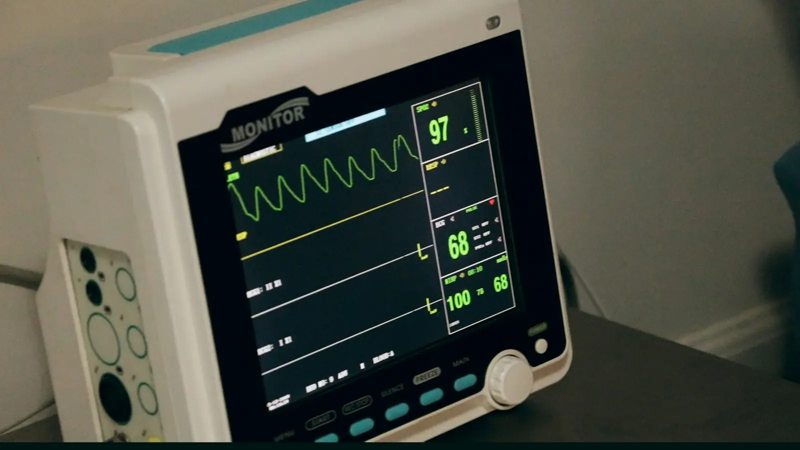 Monitor multiparamétrico em ambiente hospitalar